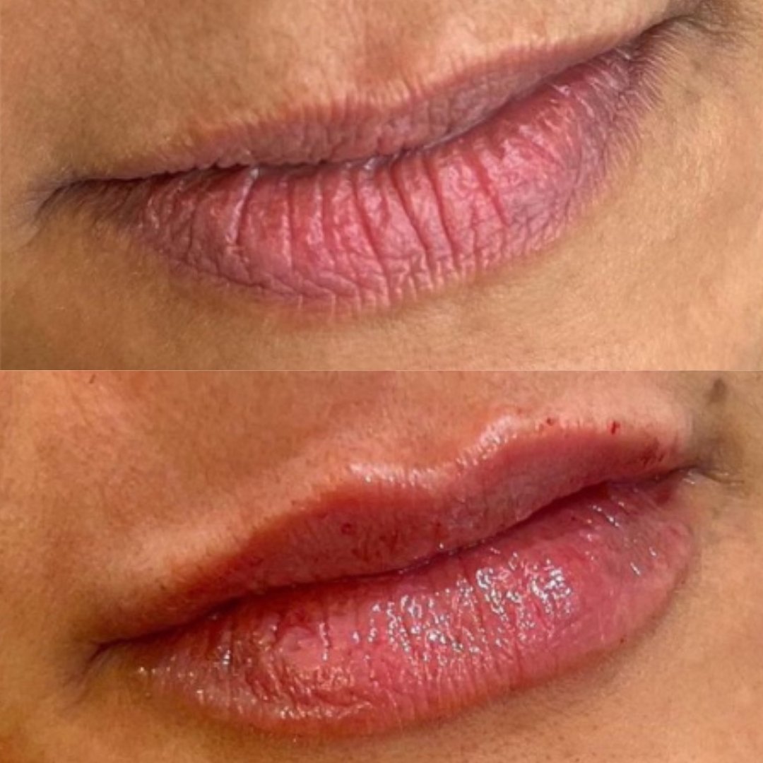 Labios